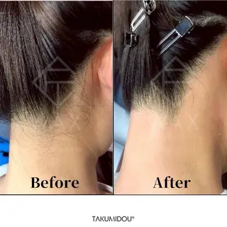 JYUNESU所属・眠れるワックス脱毛 ・銀座のエステ・リラクイメージ