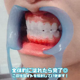 LBSホワイトニング 🌐渋谷店スタッフのエステ・リラクイメージ