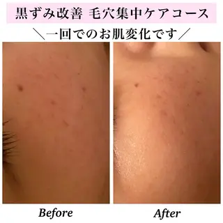 Bellesthe （ベルエステ）のエステ・リラクイメージ