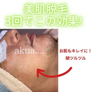 akua... 【肌質管理専門】のその他イメージ