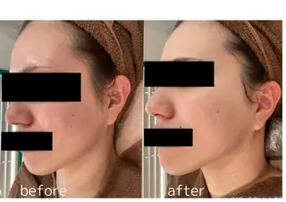 Beauty salon dessert（ビューティーサロンデザート）所属・板垣 あゆみのエステ・リラクイメージ