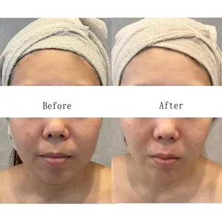 Lavieriche "ラヴィリッシュ"のエステ・リラクイメージ