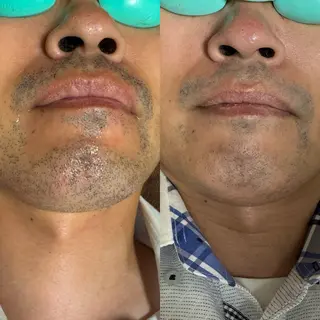 六本木脱毛andS 店長Sachiのエステ・リラクイメージ