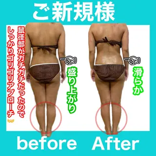 痩身/脱毛/ネイル HARUKAのエステ・リラクイメージ