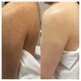 カラー aliaハイフ&水光ジェットサロン所属・aliaハーブ水光店 エステティシャン募集のエステ・リラクイメージ