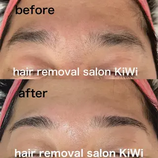 アイブロウ 脱毛サロン KiWiのエステ・リラクイメージ