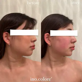 エステサロンino.colore'所属・小顔サロン ino.coloreのエステ・リラクイメージ