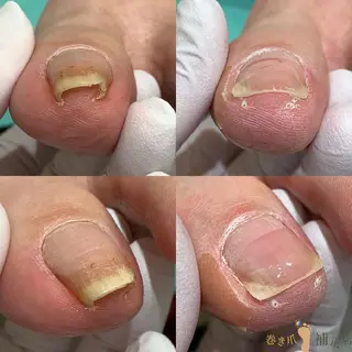 ネイル 東京巻き爪アカデミー所属・東京巻き爪 アカデミーのエステ・リラクイメージ