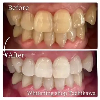 セルフ ホワイト ニングショップ立川のその他イメージ