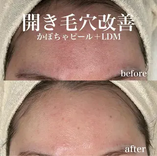 韓国肌管理&小顔 ＩＲＯＨＡのエステ・リラクイメージ