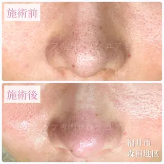 毛穴肌質ケアサロン Yourmeユアミーのエステ・リラクイメージ