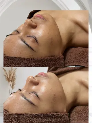 Daisy ~Beauty care by DANA~所属・ハーブピーリング🌿 danaのエステ・リラクイメージ