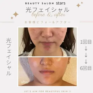 赤羽Stars beautyのエステ・リラクイメージ