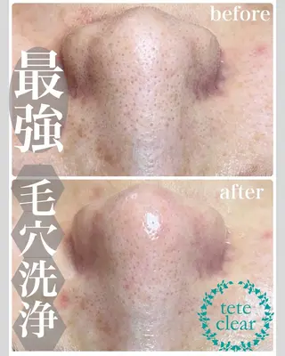 Soin＋ みきのエステ・リラクイメージ