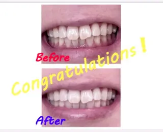 セルフホワイトニングサロン　ラヴィアン所属・ホワイトニングサロン La vie enのその他イメージ