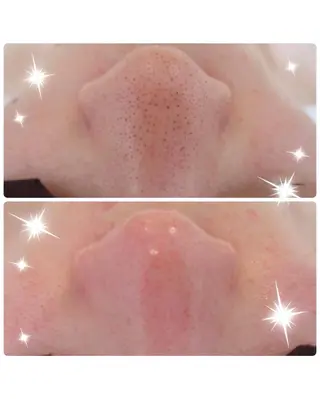 Crescent Beautyのエステ・リラクイメージ