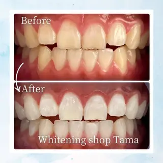 ホワイトニング ショップ多摩店のその他イメージ