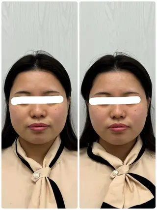 美容鍼×小顔矯正 ×美容整体　浜川泰仁のエステ・リラクイメージ