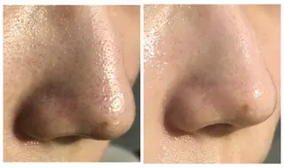 Reid-月詠-所属・Reid -月詠-のエステ・リラクイメージ