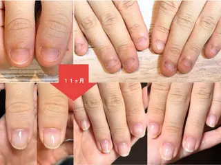 ネイル 深爪矯正・自爪育成 ネイルサロンアモまいのネイルデザイン