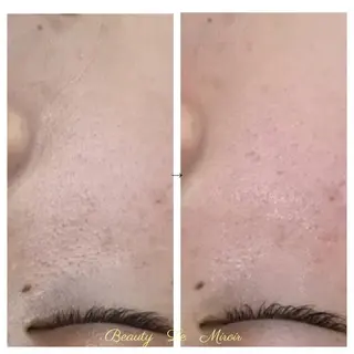 ビューティー ミロワールのエステ・リラクイメージ