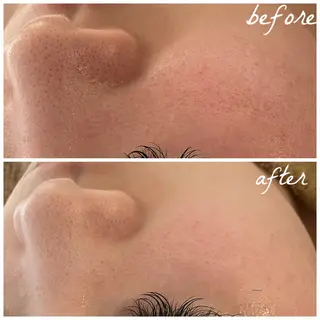 メンズ メナード岐阜茜部 杉浦のエステ・リラクイメージ