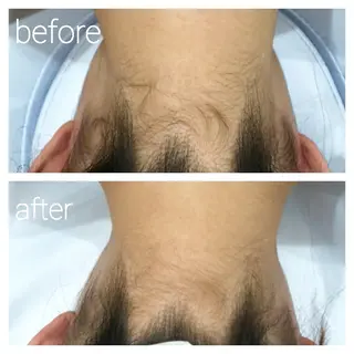 N.Sサロン Miyauchiのエステ・リラクイメージ