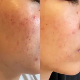 小顔×痩身専門サロンCLORE浦和店所属・石川 彩花のエステ・リラクイメージ