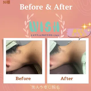 WISH 美肌脱毛のプロ！須藤のエステ・リラクイメージ
