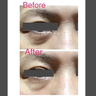 エヴァーグレース 河原町店のエステ・リラクイメージ