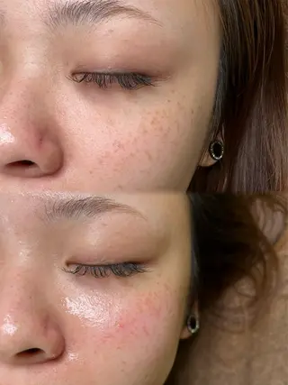 Nalu所属・まつ毛パーマ／脱毛 Naluのエステ・リラクイメージ