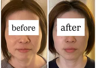 99-KUKU-所属・天神美容鍼99 -KUKU-吉弘萌香のエステ・リラクイメージ