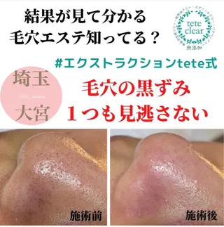 private salon  Dea_maris シュガーリング＆パーソナルボディケア所属・シミ改善・韓国肌管理 ボディメイク痩身のその他イメージ