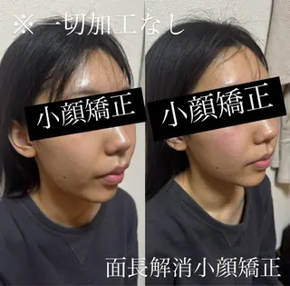 Amaranth所属・Lupinus 小顔矯正のエステ・リラクイメージ