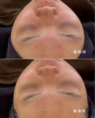 écla【中崎町】 yukikoのエステ・リラクイメージ