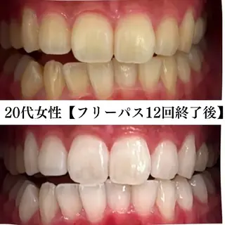 キッズ メンズ セルフホワイトニング WHITE福岡博多店のエステ・リラクイメージ