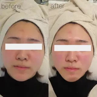 CLEAD 赤坂見附店のエステ・リラクイメージ