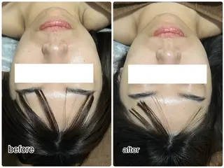 ENCHANT Kaede/肌質改善のその他イメージ