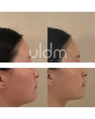 crescent所属・【韓国肌管理・脱毛】 クレセントのエステ・リラクイメージ