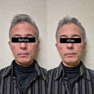 小顔矯正 LNのエステ・リラクイメージ