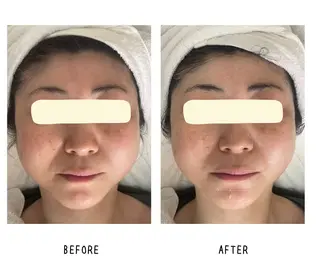 grow所属・Yoshino Erinaのエステ・リラクイメージ