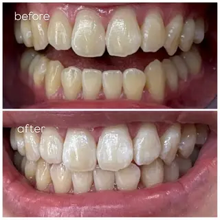 エクシア津駅前店所属・セルフホワイトニング エクシア津駅前店のその他イメージ