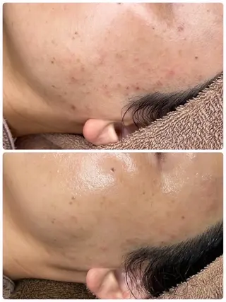 メンズ 中目黒ハーブピーリン グ🌿ララピールのエステ・リラクイメージ