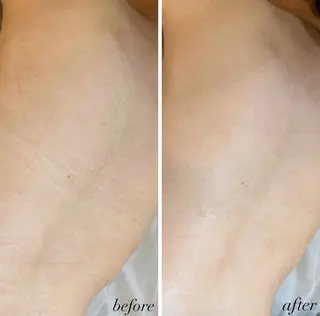 うなじ脱毛/美肌脱毛 LABELのエステ・リラクイメージ