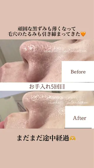 都度払い 肌質改善専門サロンのエステ・リラクイメージ