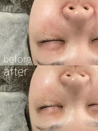 LBSホワイトニング 🌐岡山店のその他イメージ