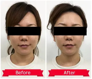 小顔の専門店　理想の小顔【リソウノコガオ】福島店所属・KOTO SALONのエステ・リラクイメージ