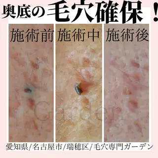 プライベートサロン Gardenのエステ・リラクイメージ