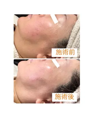 小顔・毛穴・たるみ ネイル　似内真樹のエステ・リラクイメージ