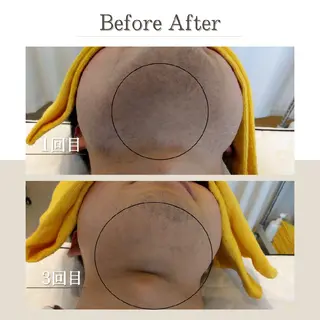 メンズ EDEL エーデルのエステ・リラクイメージ